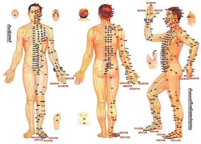 Acupuntura en Esparreguera